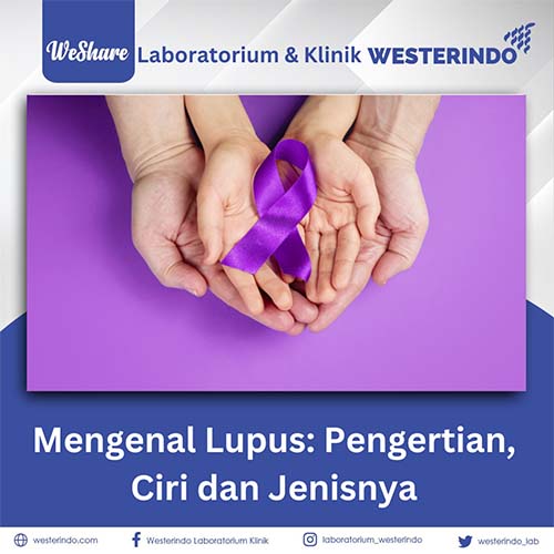 Mengenal Penyakit Autoimun ‘Lupus’