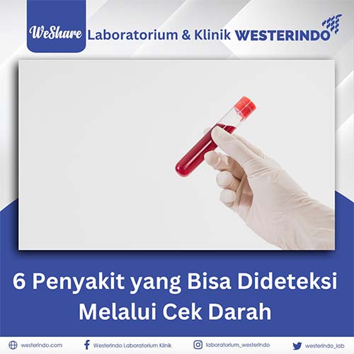 6 Penyakit yang Bisa Dideteksi Melalui Cek Darah