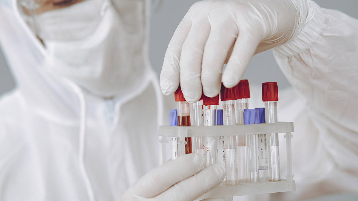 Cek Darah, Persiapan dan Larangan Untuk Dapatkan Hasil Maksimal