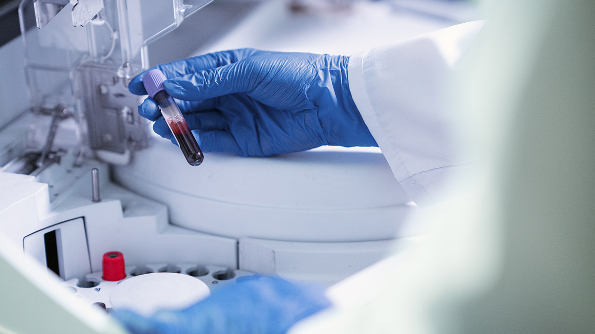 Laboratorium Kesehatan, Deteksi Dini dan Pantau Kesehatan dengan Akurat