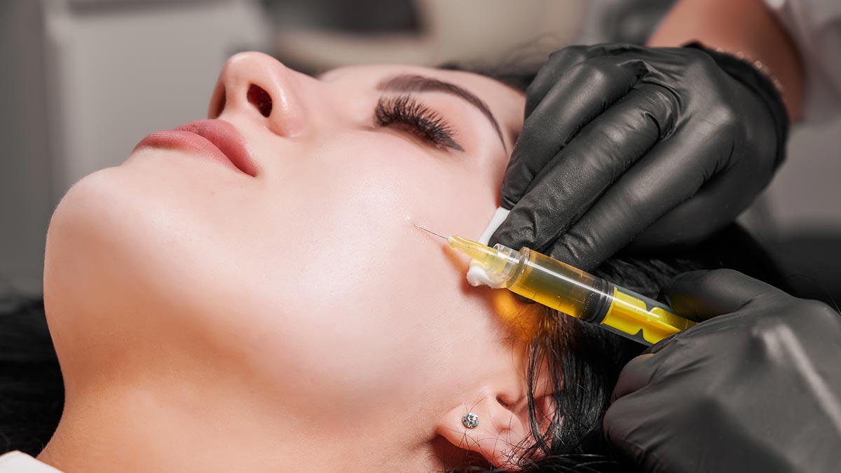 Platelet Rich Plasma / PRP, Solusi Perawatan Kulit Wajah