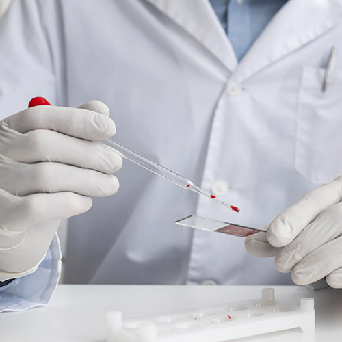 Laboratorium Klinik, Layanan Pemeriksaan Kesehatan yang Akurat, Lengkap dan Terpercaya
