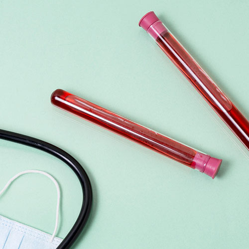 Pemeriksaan Darah Lengkap: Tes Penting untuk Deteksi Penyakit Dini