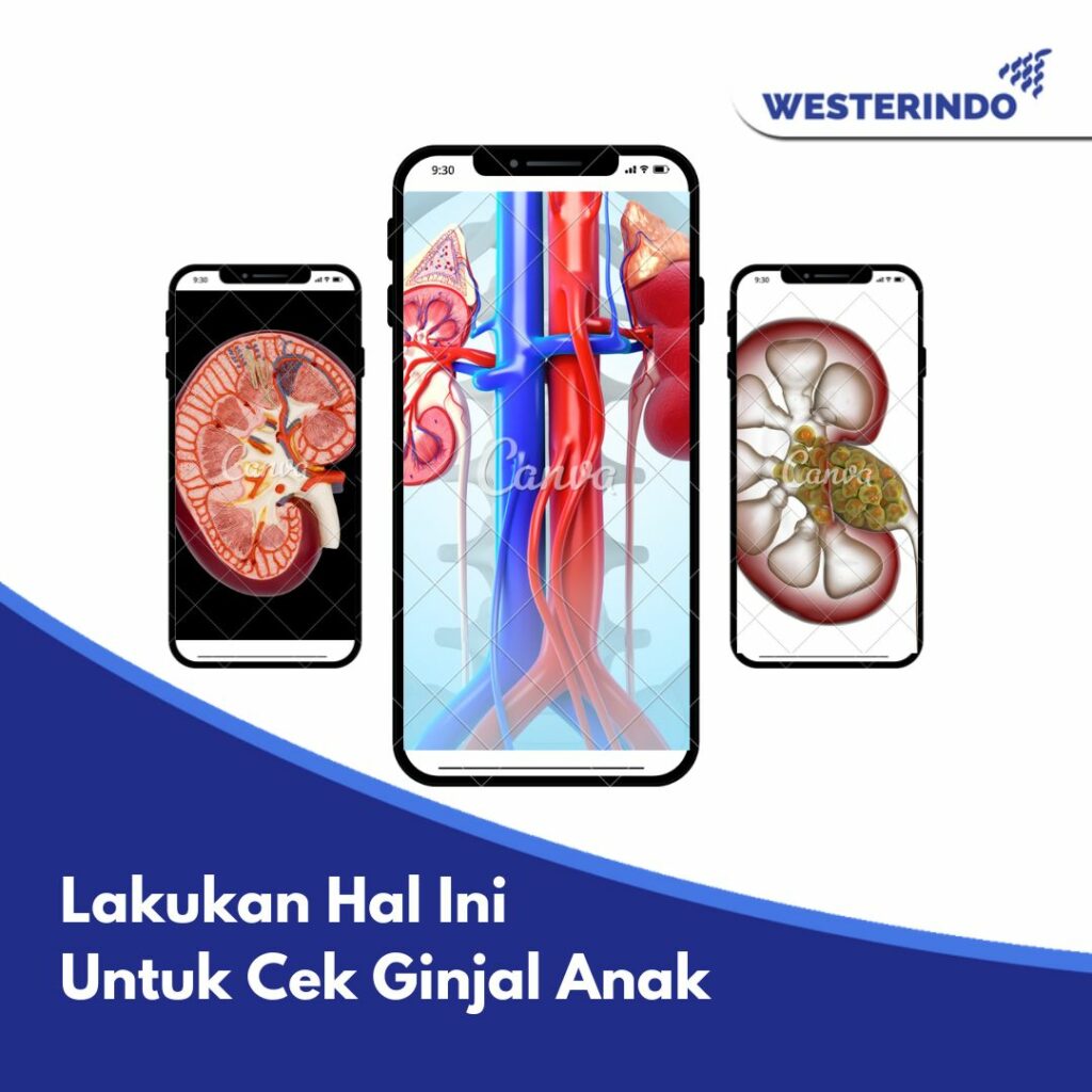 Waspada Penyakit Ginjal Anak - Laboratorium & Klinik