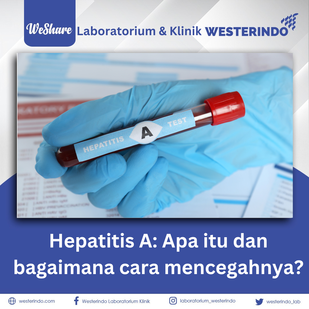 Hepatitis A Apa itu dan bagaimana cara mencegahnya