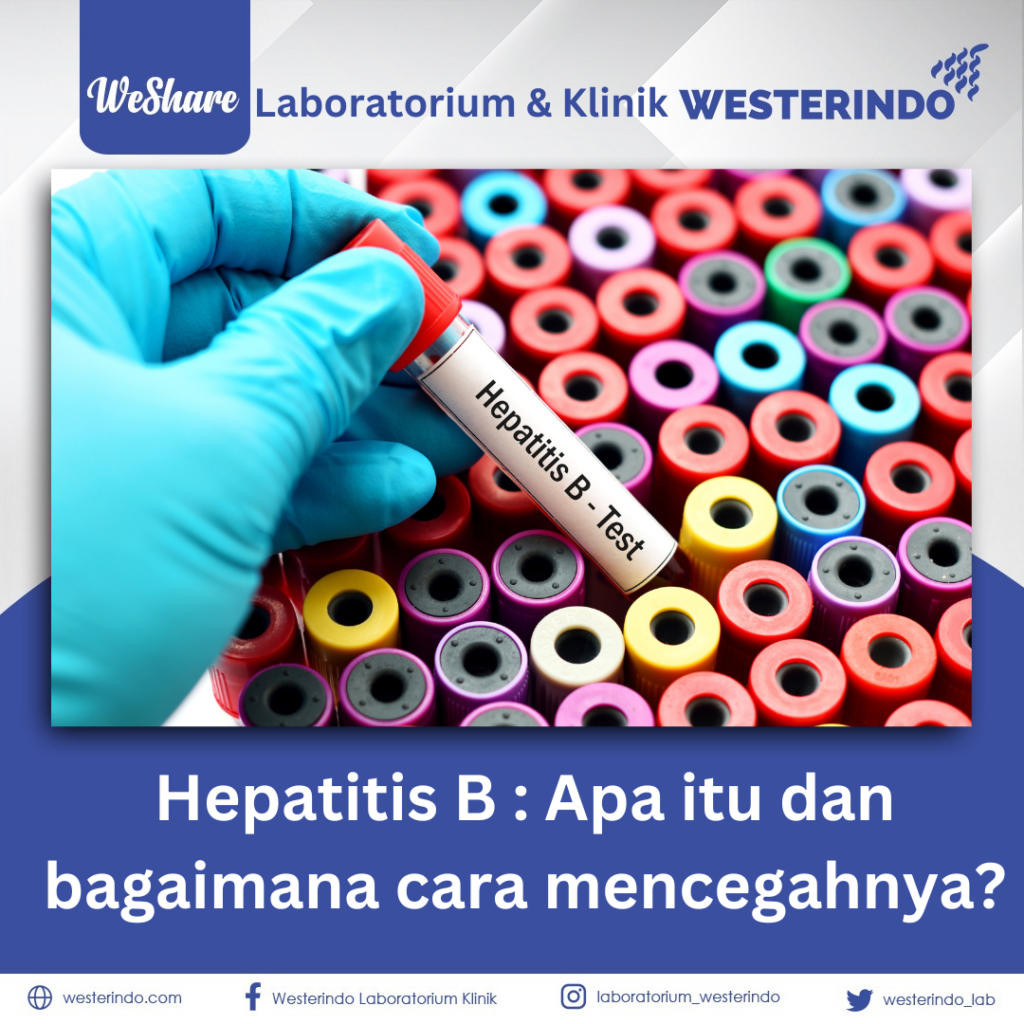 Hepatitis B : Apa Itu Dan Bagaimana Cara Mencegahnya? - Laboratorium ...