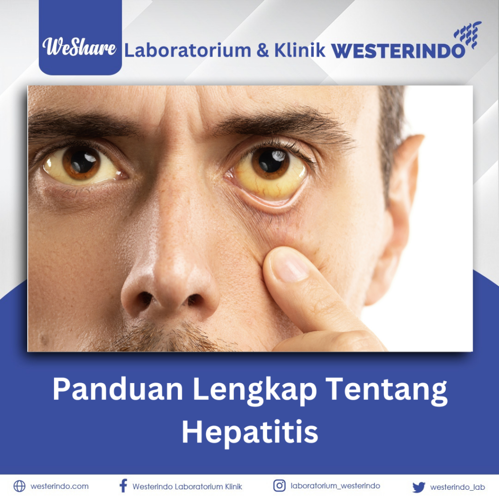 panduan-terlengkap-tentang-hepatitis-laboratorium-klinik